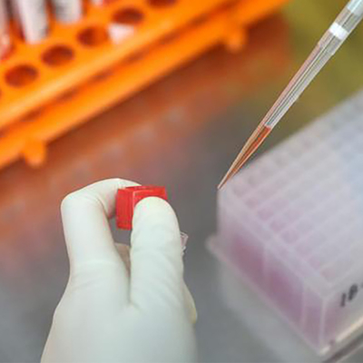 RT PCR Test Kit Virus Monkeypox MPXV CE Terdaftar 1 Test/ Box