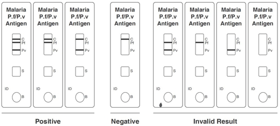 Malaria PF/PV Antigen Rapid Test Kit Colloidal Gold CE Terdaftar